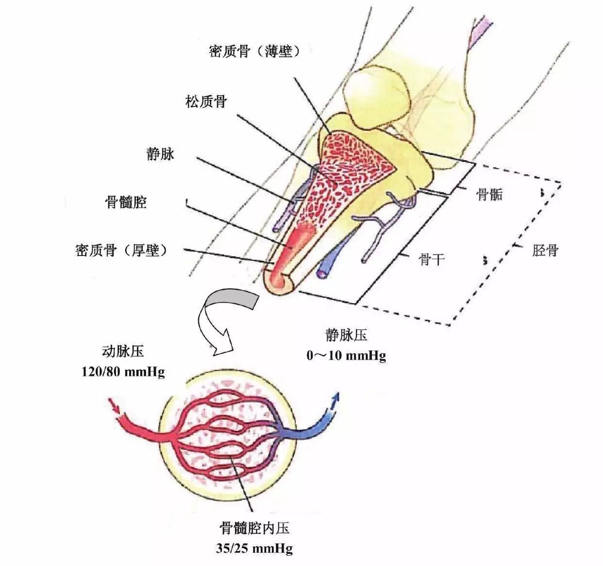 骨髓腔輸液技術(shù)